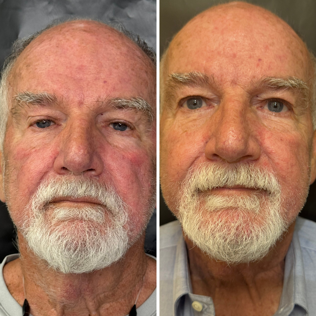 Minimalist Skincare Results